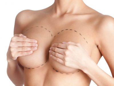 Brust vor einer Operation